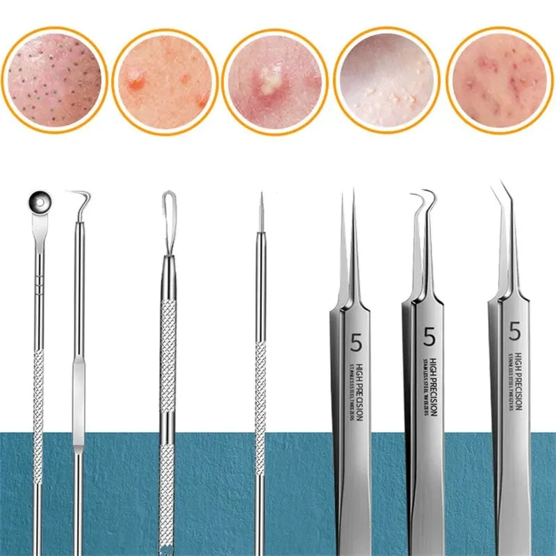 ✨ Professional 11-in-1 Blackhead Remover Kit – Acne Extractor Needles & Pore Cleansing Tools ✨