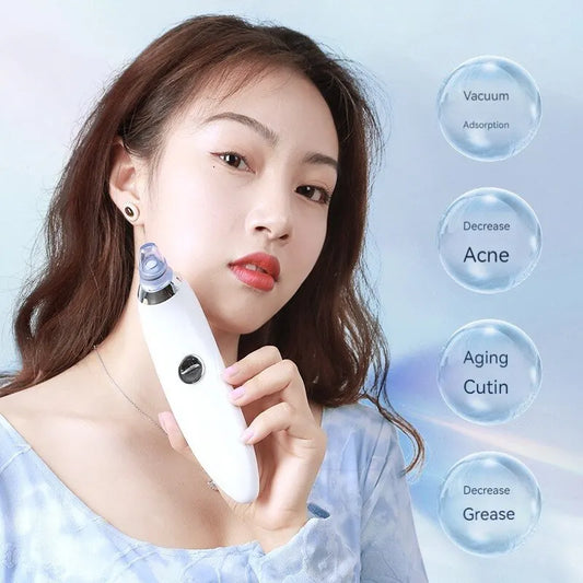 ✨ Suction Blackhead Remover Device – Deep Pore Cleansing Beauty Instrument ✨