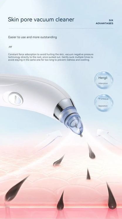 ✨ Suction Blackhead Remover Device – Deep Pore Cleansing Beauty Instrument ✨